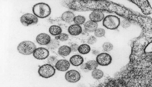 10 VIRUS PALING MEMATIKAN DI DUNIA