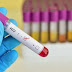 Pressure Piling On Kenya To End New HIV Infections By 2030