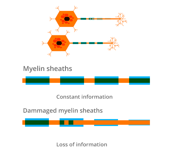MS myelin sheaths