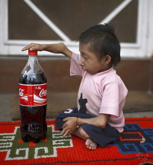 The World's Smallest Man from Nepal - 22ins tall - 16 Pics + Video