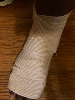 Sprained foot Fahmeena Odetta Moore