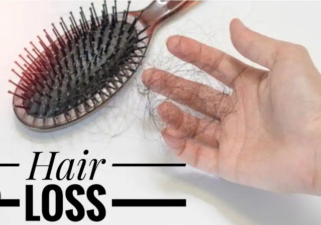 Hair Loss || Dr. Abida Sultana