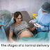 The Stages of a Normal Delivery 