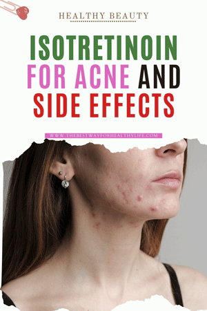 picture isotretinoin for acne