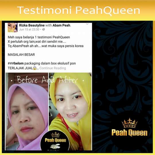 Peah Queen : Produk Kecantikan untuk Kulit Menawan 