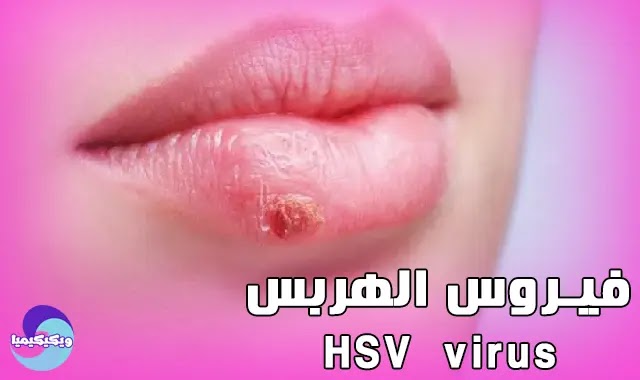 HSV virus