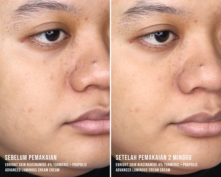Before After eBright Skin Niacinamide Cream