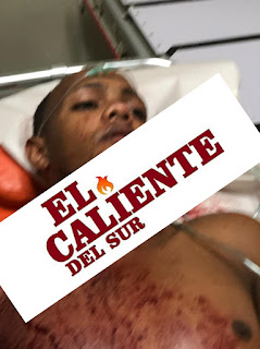 Cienaga Barahona: Sigue la violencia esta , vez se registra un Joven herido de bala en el cuello la madrugada del sábado de gloria