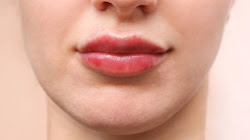 Tiêm môi bị sưng phải làm sao?