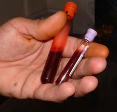 Blood Tests, Sexually-Transmitted, Oral Cancers