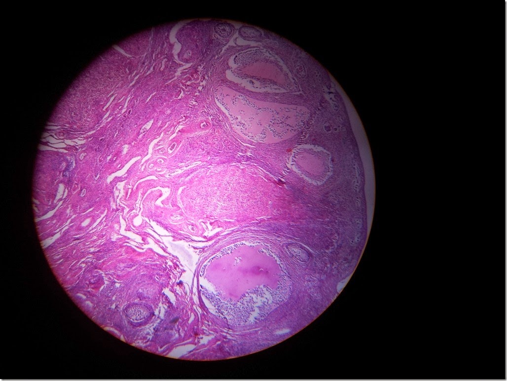 ovary_Histology_slide