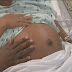 Teenage girl with no vagina gets pregnant from giving oral s£x