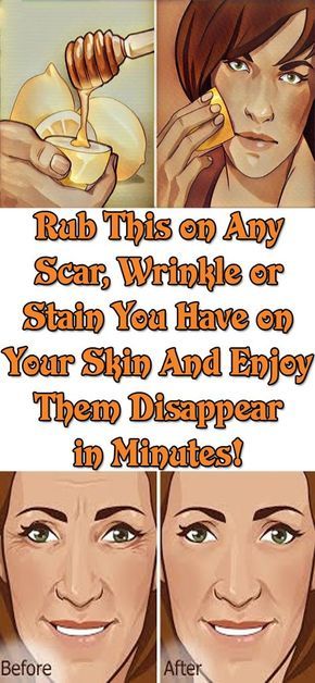 RUB THIS ON ANY SCAR, WRINKLE OR STAIN YOU HAVE ON YOUR SKIN AND ENJOY THEM DISAPPEAR IN MINUTES! EVEN DOCTORS ARE SHOCKED!