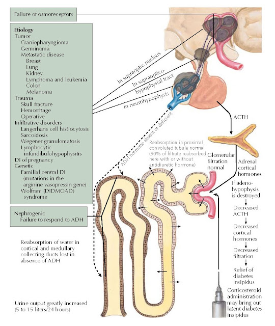 CENTRAL DIABETES INSIPIDUS