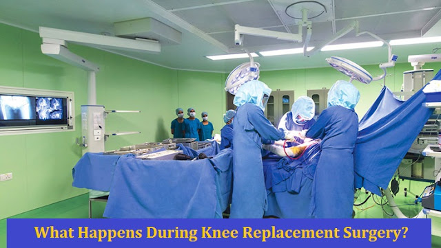 What Happens During Knee Replacement Surgery?