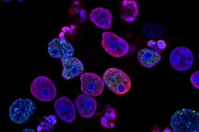 Desaparición del cromosoma Y y su impacto en el sistema inmunitario: Cómo promueve un cáncer agresivo y abre puertas a nuevas estrategias de tratamiento