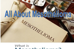 All About Mesothelioma