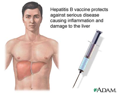 Hepatitis