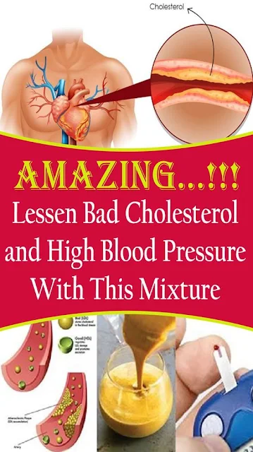 Reduce Bad Cholesterol And High Blood Pressure With This Mixture!