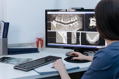 Dental Implant