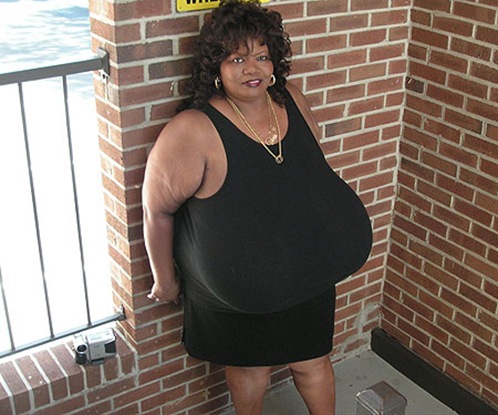 World's Largest Natural Breasts (Norma Stitz) 02