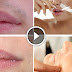 Home remedy to remove Hair From Your Upper Lips Permanently