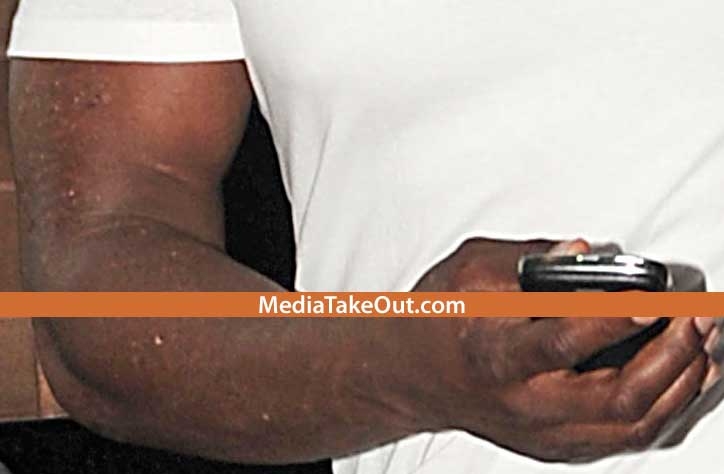 50 Cent had all the tattoos on his arm removed.