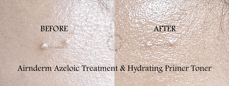 review-airnderm-azeloic-treatment-&-hydrating-primer-toner