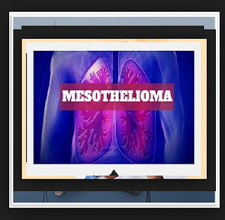 Someone Mesothelioma It Is A Dropped Human Image