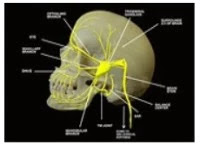 Trigeminal Neuralgia