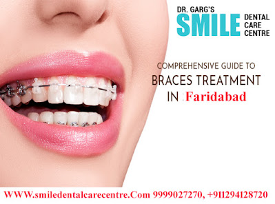 Best Braces Treatment Orthodontist in Faridabad