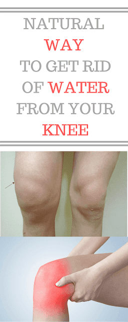 A Natural Way to Get Soothe Knee Pain and Water in Your Knee