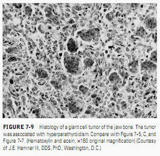 Pseudoepitheliomatous Hyperplasia