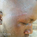Thug Attacks Supporter Of Oriade Chairmanship Aspirant, Hon. Akinwale Bimbo Lawanson In Ijebu-Jesa During Burial Ceremony