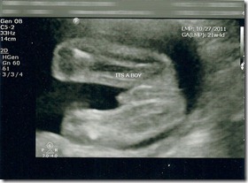 baby boy 1
