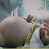 WEIRD!!! "Pregnant" 2-Year-Old Boy "Gives Birth"