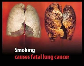 Smoking Tied to One Type of Skin Cancer