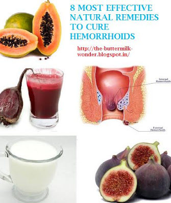 8 MOST EFFECTIVE NATURAL REMEDIES TO TREAT HEMORRHOIDS