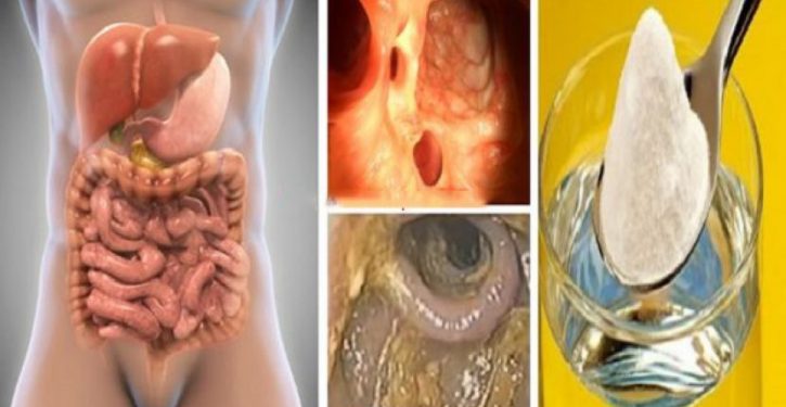 2-Day Program To Detoxify Liver, Colon, Kidneys And Remove All Toxins And Body Fats