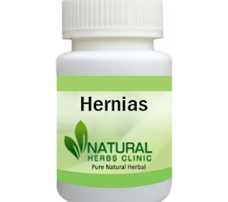 Herbal Product for Hernias