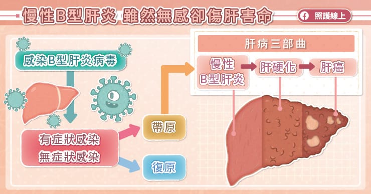 慢性B型肝炎，雖然無感卻傷肝害命