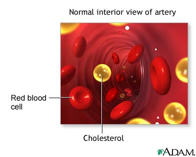 BAHAS PENGOBATAN ALTERNATIF: Pengobatan Kolesterol & Asam 