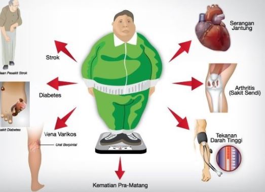 Cara Mudah Menurunkan Berat Badan Tanpa Olah Raga Dan Obat 