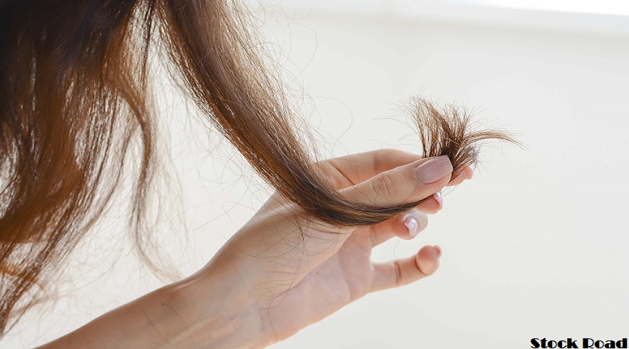 सर्दियों के मौसम में बालों में बढ़ता है रूखापन, इन तरीकों से रोकें ड्राइनेस (Dryness in hair increases during winter season, prevent dryness with these methods)