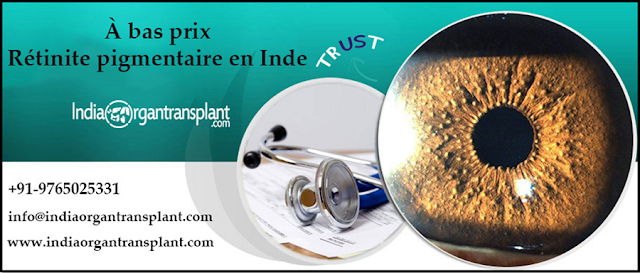 https://www.indiaorgantransplant.com/retinitis-pigmentosa-treatment-eye-implant-at-affordable-cost-in-India-french.php