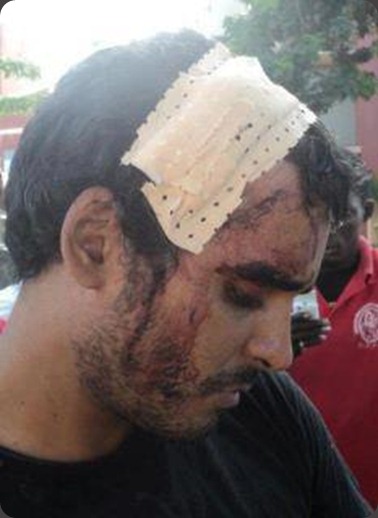 Luaty