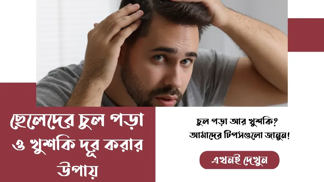 ছেলেদের-চুল-পড়া-ও-খুশকি-দূর-করার-উপায়