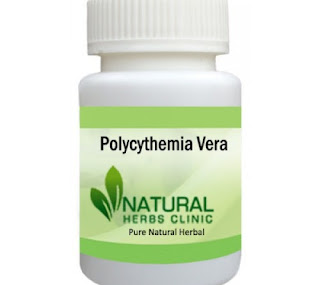 Herbal Product for Polycythemia Vera