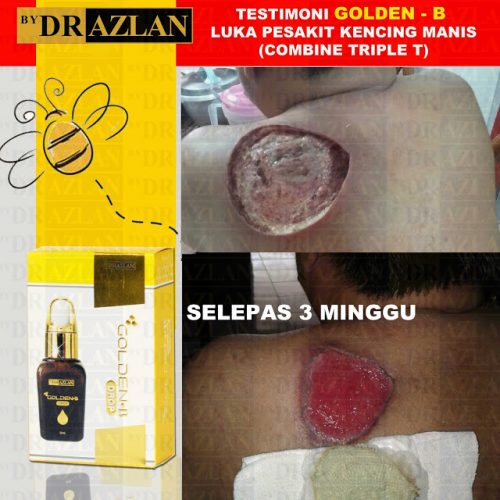 testimoni Golden-B bydrazlan