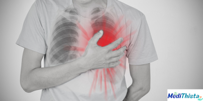 Causes Of Chest Pain